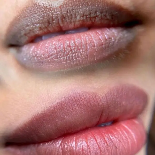 Neutralización de labios